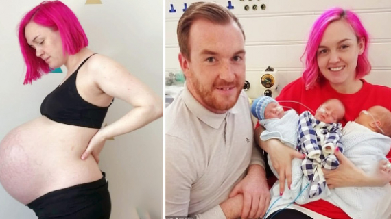 God Sent This Special Gift From Heaven! The Couple’s Agony Turns To Joy As Triplets Arrive On The Same Date They Lᴏsᴛ Baby