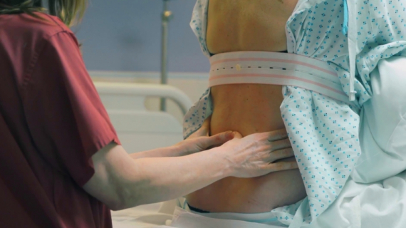 Having an Epidural in Labour