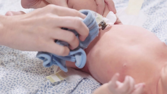 How to Care for a Baby’s Umbilical Cord?