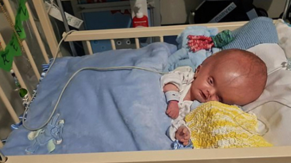 I Refused To Abort My Baby Just Because Of His Swollen Head – Now He’s Defying All The Odds