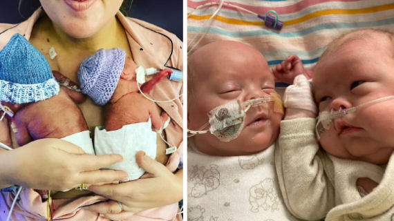 Miracle Babies Survive Birth At Just 22 Weeks – Making Them The UK’s Most Premature Twins