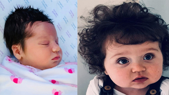 Miracle Baby Was Born With A Full Head Of Hair