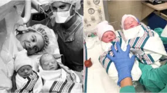 Mom Of Rare Twins Share Her Adorable Twins With Down Syndrome, Touching To Reader