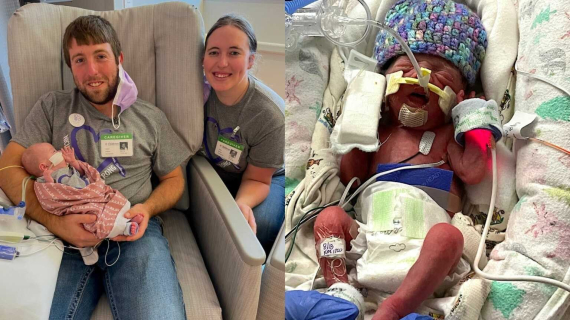  Mom Shares Surprise Pregnancy, Micro-Preemie Nıcu Journey