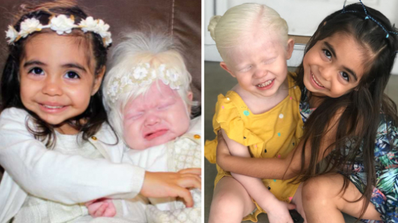Mom Unexpectedly Births Beautiful ‘Albino Princess’