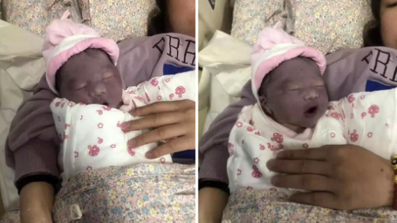 Mom Was Shocked When First Met Newbon Baby