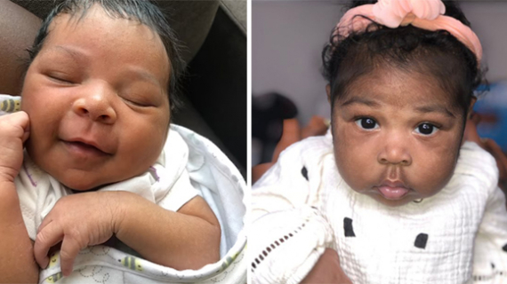 Mum Shocked After Baby Grows Thick Hair All Over Body - But Says She's Still Gorgeous