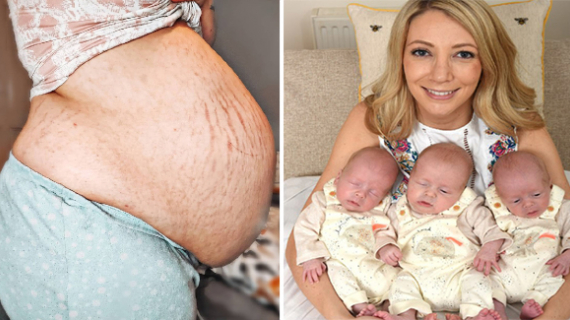Mum Stunned When She Discovered She Was Pregnant With Identical Triplets