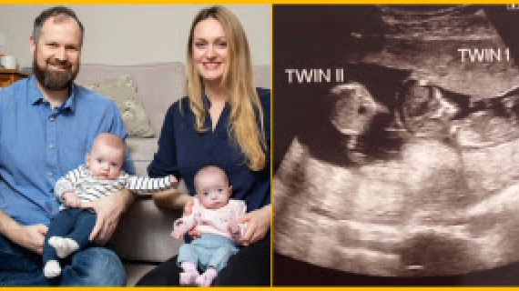 Mum Surprised To Discover She’s Pregnant With Second Child – While Already Expecting