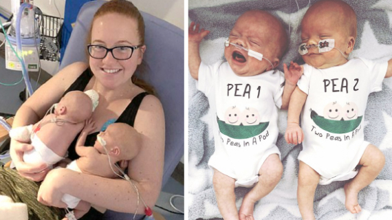 Mum Who Fell Pregnant With Twins Stunned When They Were Born Two Days Apart