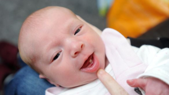 Mum's Shock As Baby Daughter Is Born With A Tooth - And It's Now 'Massive'