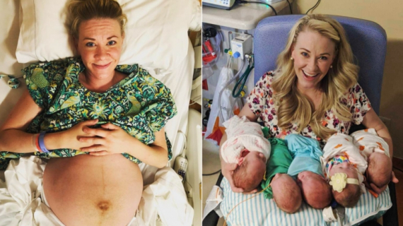 Only One in 55 Million Pregnancies: Mom Delivers Quintuplets in 60 Seconds