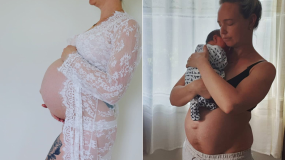 Post-baby Body Photos: "I Want Every Mom To Know That It’s Normal And You’re Beautiful"