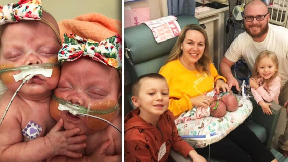 Preemie Twins Born at 22 Weeks Are Breaking Records