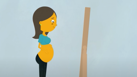 Pregnancy stretch marks