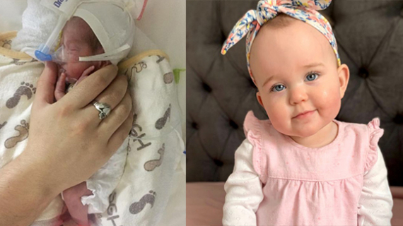 Premature Baby Born Smaller Than Her Toy Rabbit Celebrates First Birthday