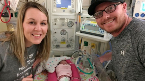 Record-Breaking Premature Baby Twins Survive Being Born 18 Weeks Early – The Rare Case