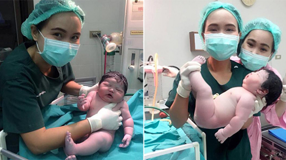 See Adorable Photos Of This ‘Chubby’ Newborn Baby Who Weighed 5 Kilos And 2 Points