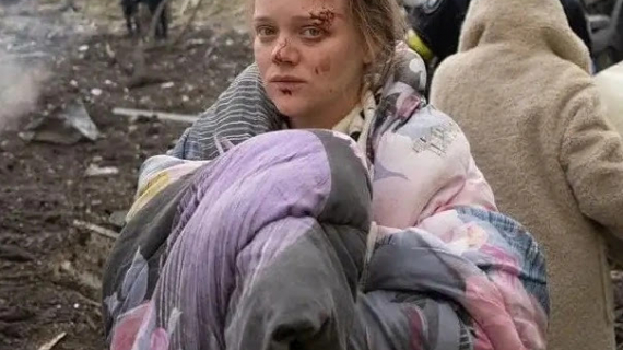 Shameless Russia Accuses Pregnant Mum-to-be Of Faking Barbaric Hospital Bombing Injuries In Pics That Shocked The World