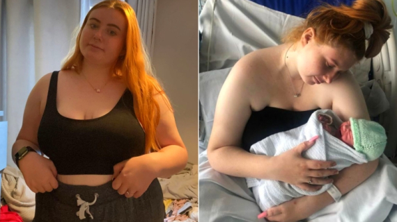 Teen Girl Who Thought She Had Constipation Gives Birth in Bedroom: Had No Idea She Was Pregnant