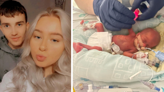 Teen Mum Gives Birth To UK’s Smallest Premature Baby In 20 Years