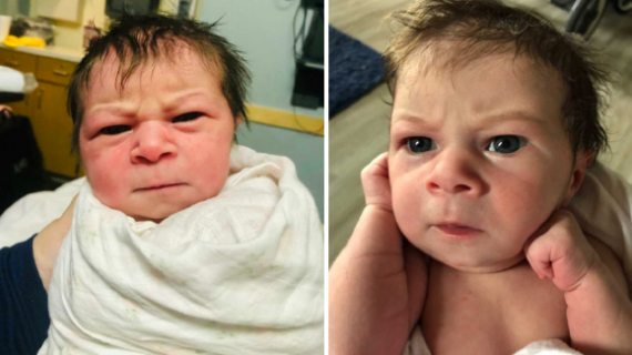 The Baby Born With Face ‘Angry To The World’