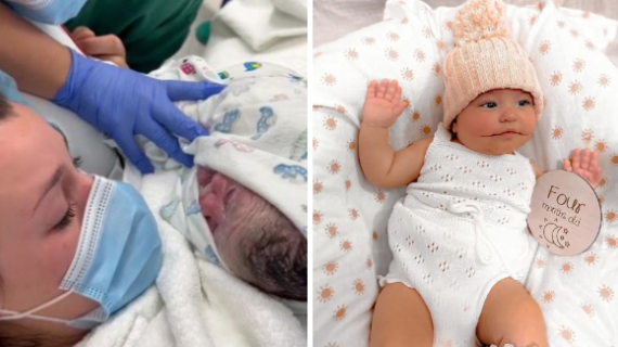 The Baby Is One In 14 Cases Rare Around The World Was Born With Permanent Smile