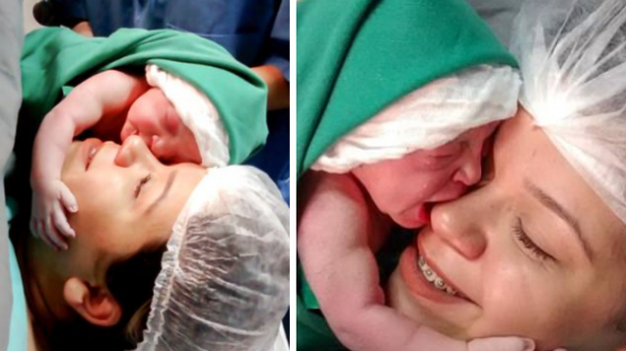 The Emotional Moment A Newborn Baby Clings On To Her Mother’s Face After Being Born