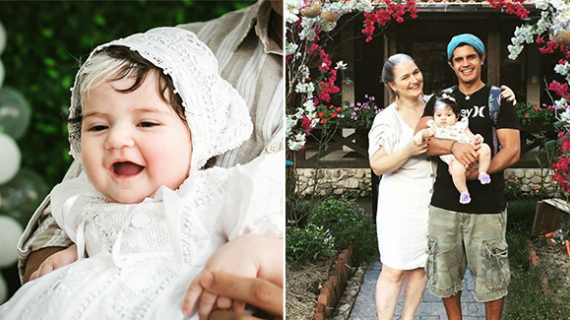 The Girl Was Born With A White Strand In Her Hair And Her Mother Does Everything So That She Appreciates Her Uniqueness