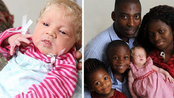 This Black Couple Given Birth To A White Baby
