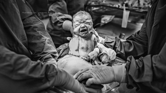 ‘This Too Is Beautiful. This Too Is A Miracle.’: Birth Photographer Empowers C-Section Moms To Realize Their Births Are Not ‘Diminished, Reduced’