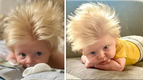 Three Months Baby Becomes A Celebrity Thanks To His Resemblance To Boris Johnson
