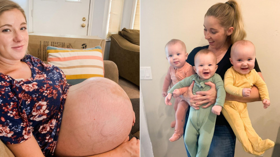 Triplets' Mother Shares Amazing Before & After Pregnancy Photos