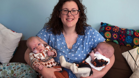 Twin Girls Born At Just 23 Weeks Were So Tiny They Fitted In One Hand - But Look At Them Now