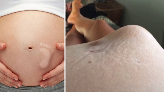 Unborn Baby in Womb Baby Kicking: 7 Facts You Need To Know