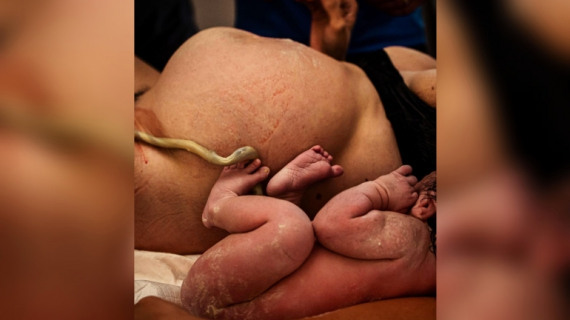 Uterus Doesn’t Stop Working As Soon As Baby is Born