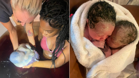 Astonishing Moment: Vaginal Twin Home Birth (En Caul)