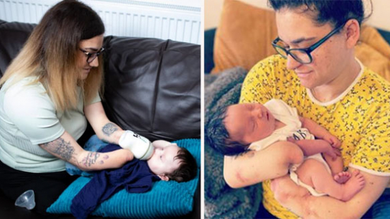 Woman Who Had Legs And Hands Amputated Given Never Chance Of Survival Miraculously Becomes A Mum