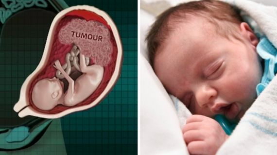 A Miracle: Baby is 'Born Twice' at Texas Hospital