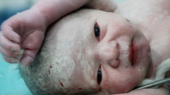 Amazing Moment: Newborn Baby Cries for the First Time