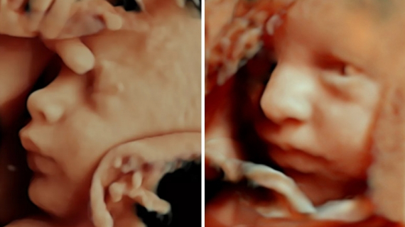 Amazing Things Fetuses Do in the Womb