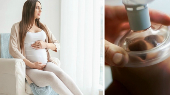 Atrial Septal Defect During Pregnancy