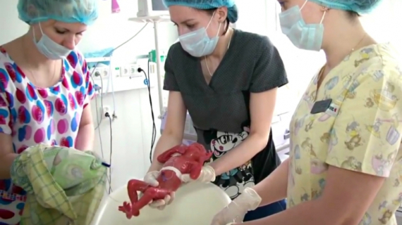 Very Little Baby Born at 28 Weeks
