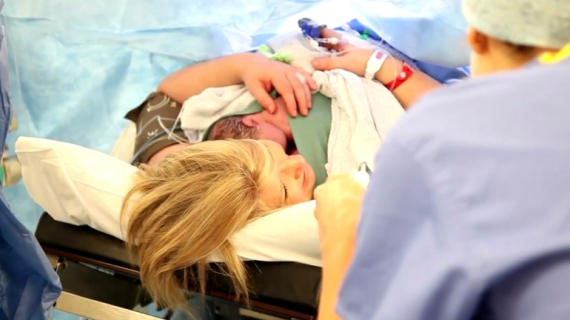 Baby-Friendly Caesarean Birth