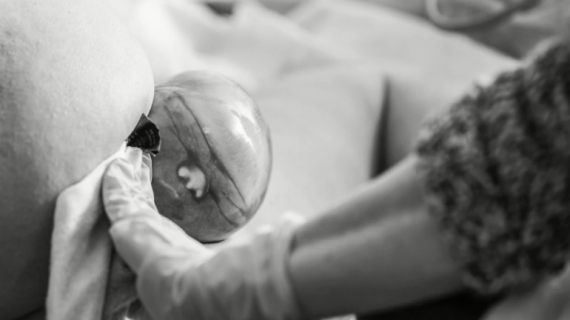 Baby Was Born in the Caul After a Powerful Labor