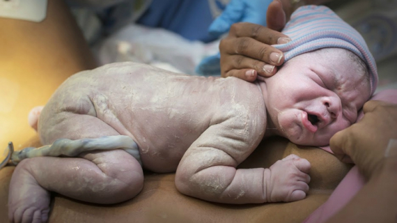 10 Beautiful Umbilical Cords