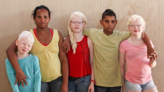 Black Brazilian Family Have Three White-Skinned Children