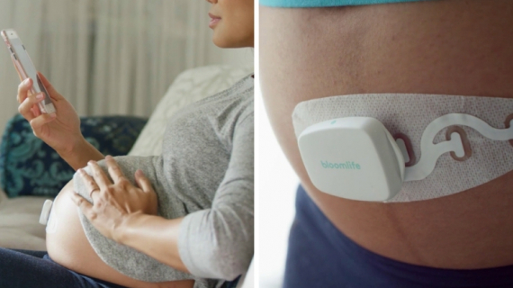 Bloomlife Smart Wearable Pregnancy Tracker