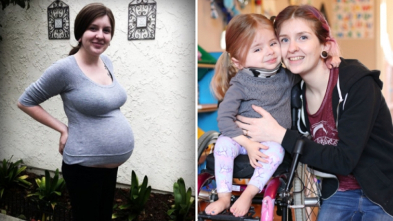 Born Different: The Child Who’s Made Of ‘Glass’