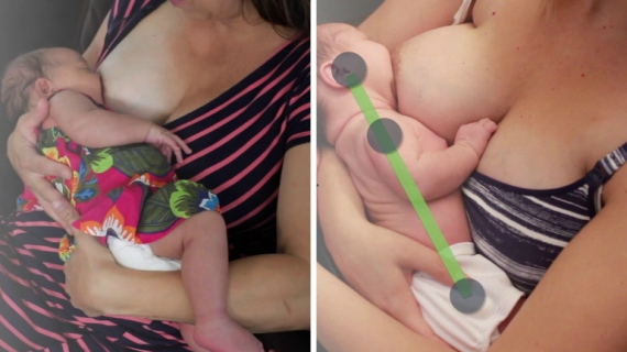 Breastfeeding Difficulties: How to Prevent and Heal Sore Nipples?